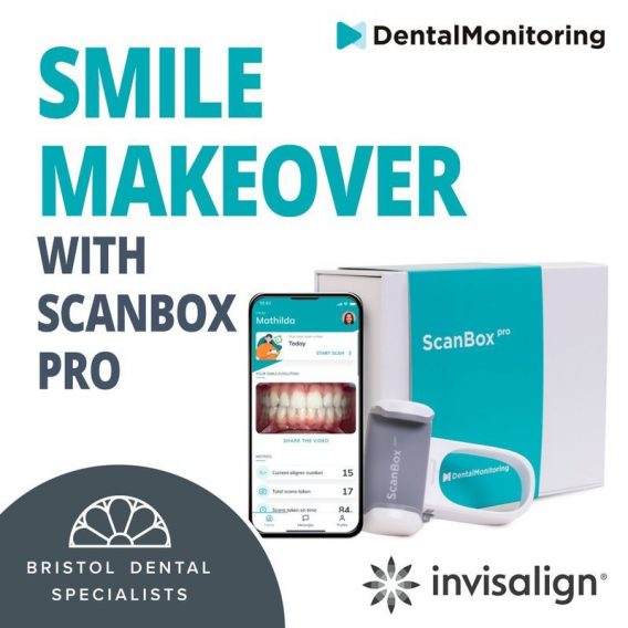 Straightening Teeth Invisalign