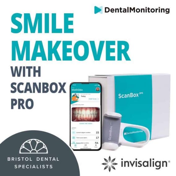 Straightening Teeth Invisalign